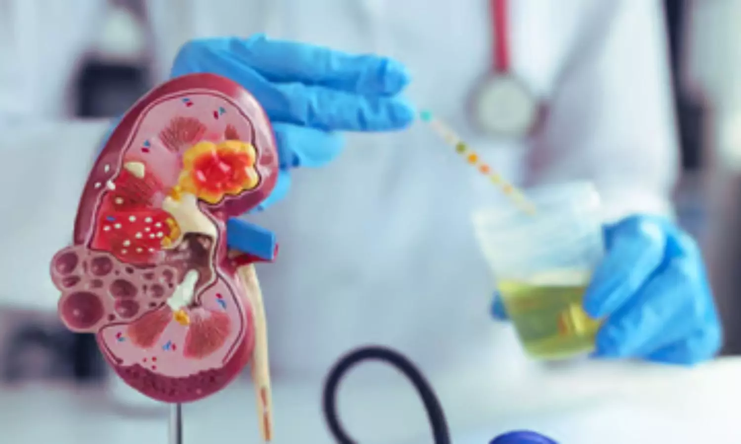 Read more about the article Left Atrial Remodeling Predicts Cardiovascular Risk in Asymptomatic Diabetes Patients with Early CKD: Study