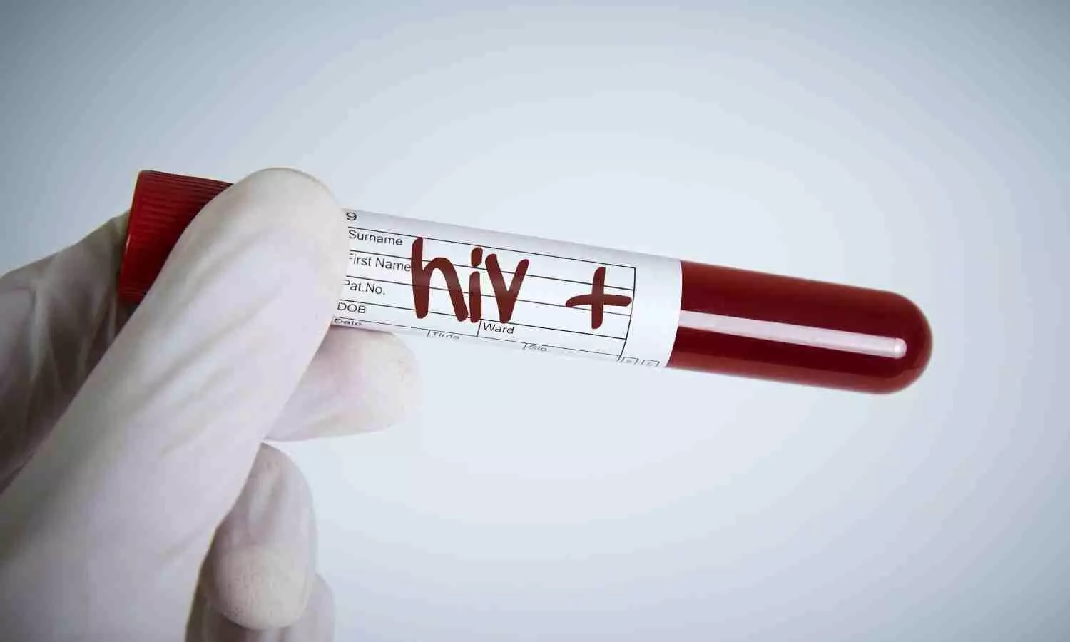 You are currently viewing Mizoram Health Minister calls for urgent action as State leads in HIV cases