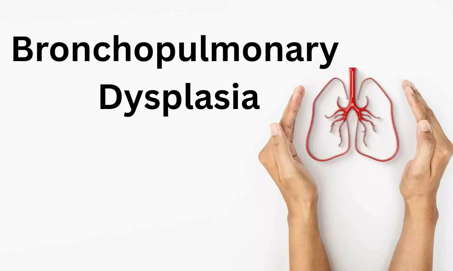 You are currently viewing Ciliary dysfunction linked to bronchopulmonary dysplasia severity, suggests research