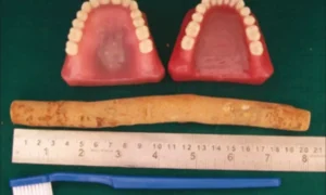 Read more about the article Toothbrush-shaped ultrasound allows for gum monitoring, reports research