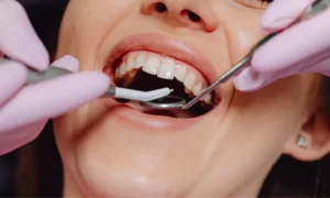 Read more about the article Combination of exercise and omega-3 reduces the severity of tooth root infections, suggests study