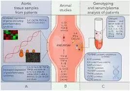 Read more about the article CCR2 Identified as Promising Biomarker for AAA-Associated Aortic Disease: Study