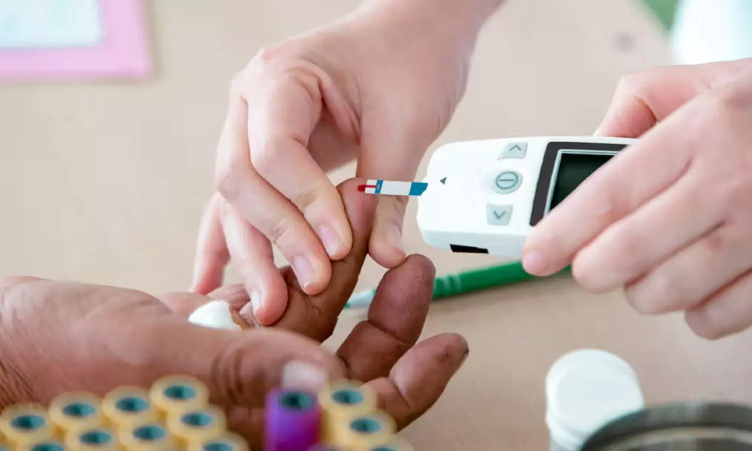 You are currently viewing Stress Hyperglycemia Ratio Identified as Predictor of Early Mortality in Acute CV Disease: Study