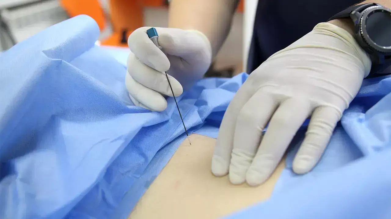 You are currently viewing Intercostal Nerve Block Matches Epidural for Pain Relief in minimally invasive Lung Surgery: JAMA