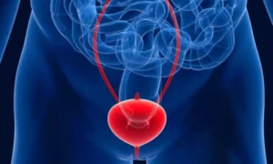 Read more about the article Childhood Gut and Urinary Disorders May Triple Risk of Interstitial Cystitis in Adulthood: Study Finds