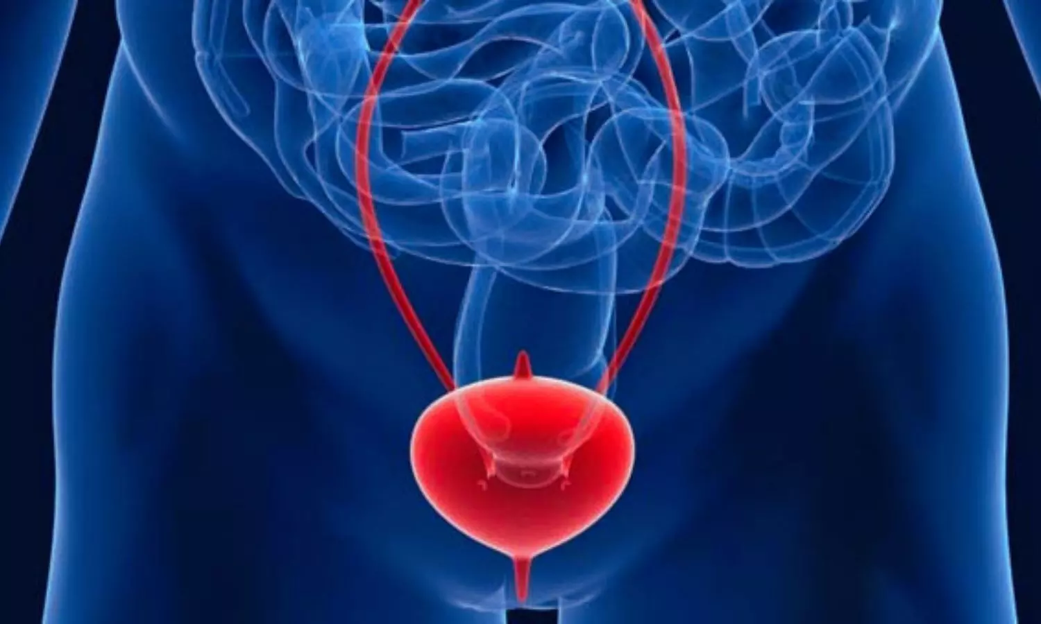 You are currently viewing Childhood Gut and Urinary Disorders May Triple Risk of Interstitial Cystitis in Adulthood: Study Finds