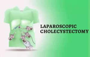 Read more about the article Laparoscopic Cholecystectomy Safe and Feasible in Pregnancy: Study