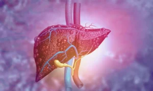 Read more about the article Study Finds GLP-1 RAs May Lower Liver and Heart Complications in MASLD Patients with Diabetes