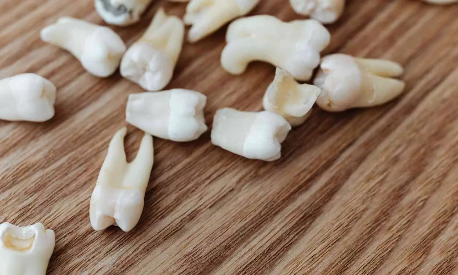 You are currently viewing Adenoid Hypertrophy Linked to Delayed Dental Development but Not Skeletal Growth in Children: Study