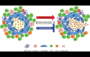 Read more about the article Increased TB Risk in Psoriasis Patients on Etanercept Despite Isoniazid Prophylaxis: Study