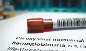 Read more about the article Rare Blood Disorder Leads to Severe Kidney Damage in Untreated PNH: Case Report