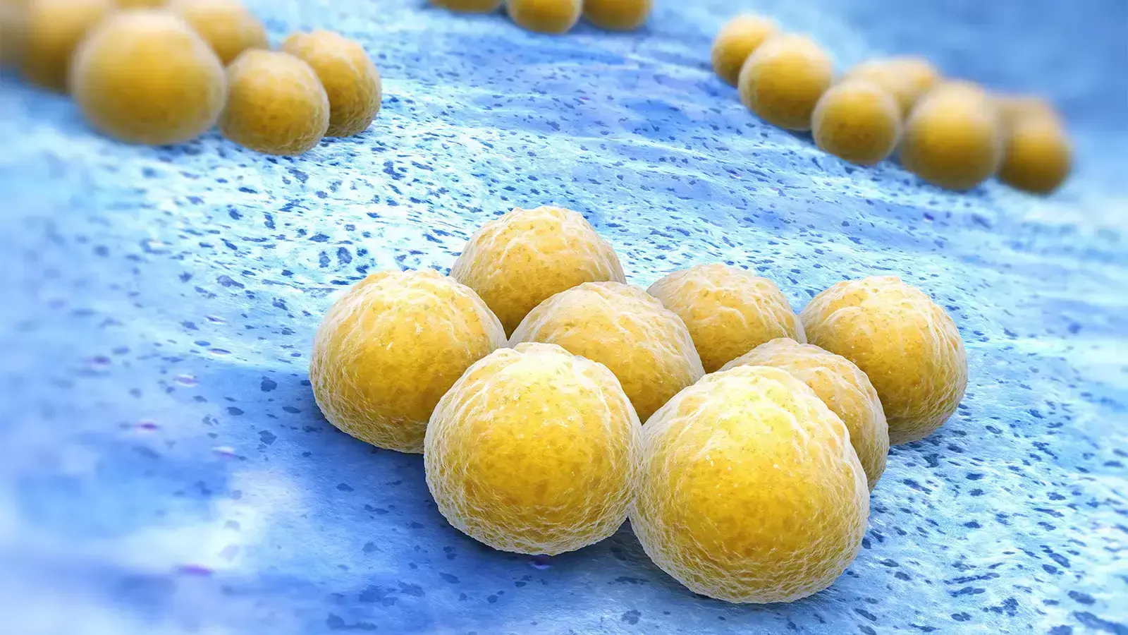 You are currently viewing Dalbavancin Shows No Superiority Over Standard Care for Complicated S. aureus Bacteremia: Study