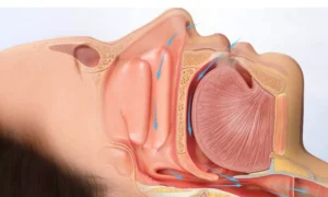Read more about the article Undiagnosed Sleep-Disordered Breathing Worsens Heart Function in HCM Patients: JAMA