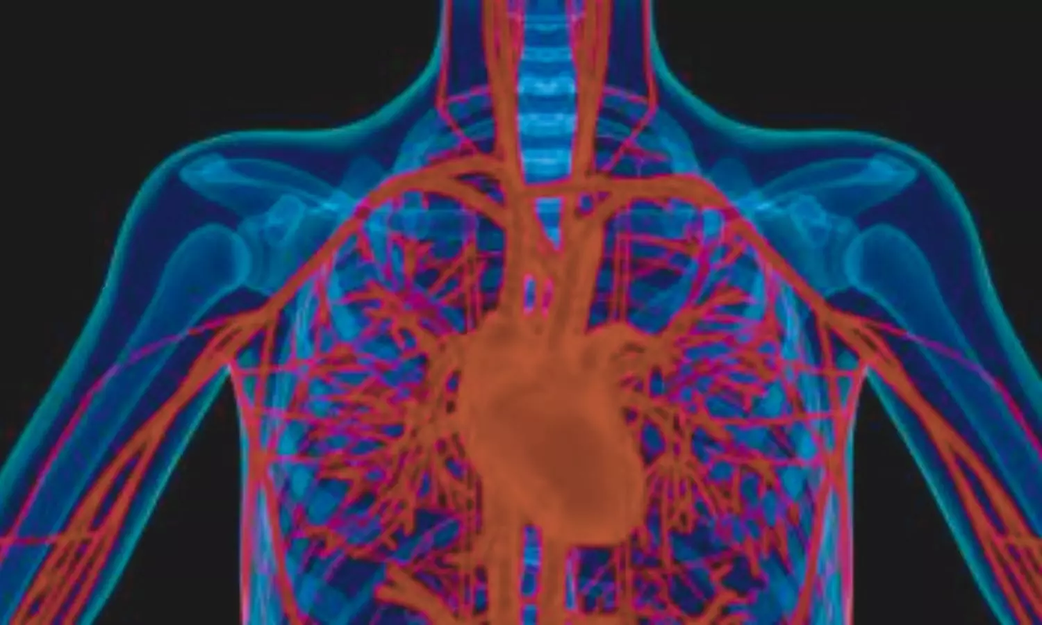 Read more about the article Study Links Metabolic Syndrome to Adverse Coronary Plaque Profiles in T2DM