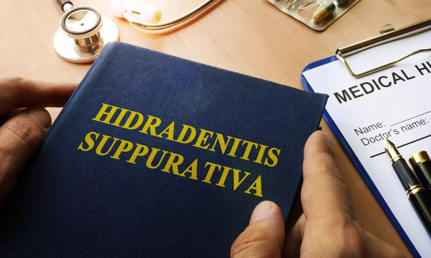 You are currently viewing Hidradenitis Suppurativa Linked to Higher Risk of Serious Eye Diseases: Study