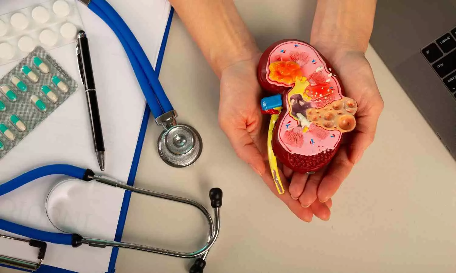 You are currently viewing Greater Kidney Complications in Patients Diagnosed with Type 2 Diabetes Before 40: Study Finds