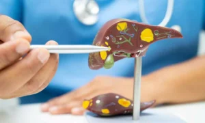 Read more about the article Tirzepatide- A novel therapeutic against metabolic dysfunction-associated steatotic liver disease, reports research