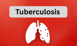 Read more about the article Low BMI Raises Risk of TB in IGRA-Positive Contacts,  suggests research
