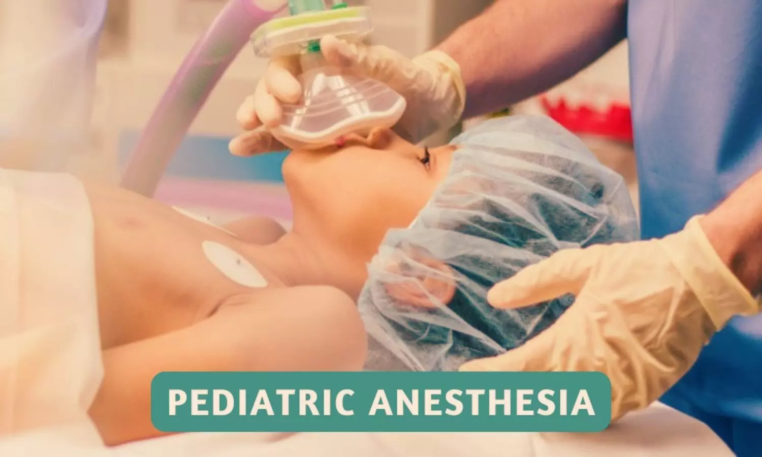 Read more about the article Sedating Smiles:Promise of Nebulized Dexmedetomidine in Pediatric GI Endoscopy, study finds