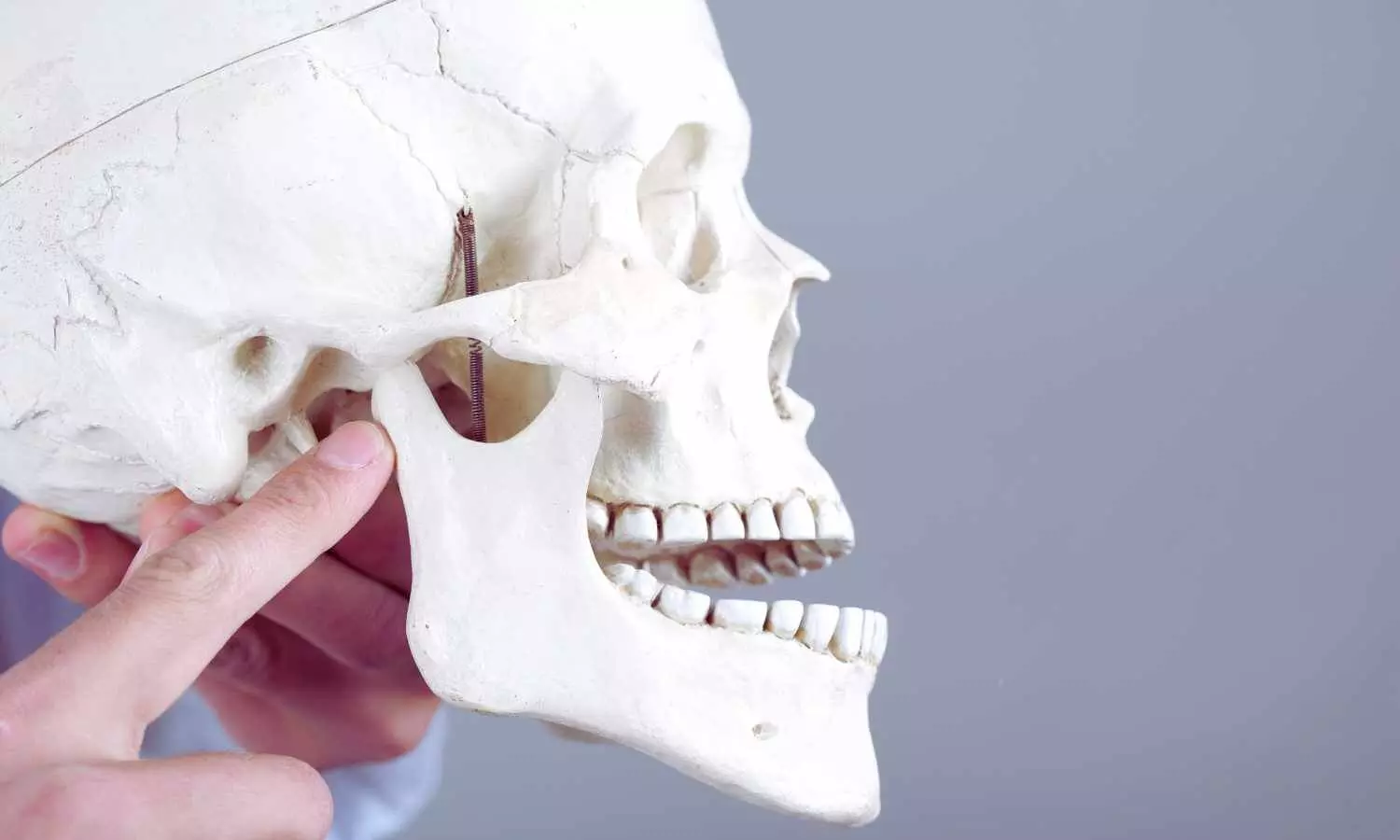 Read more about the article Mandibular Devices Effective for Severe Sleep Apnea with Hypertension: Study