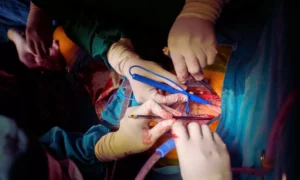 Read more about the article Dual antiplatelet therapy not more effective than aspirin alone after CABG: Study