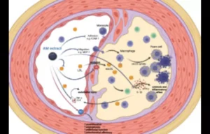 Read more about the article Aronia Extract Improves Cardiovascular Health and Reduces Inflammation in Elderly with Metabolic syndrome: Study