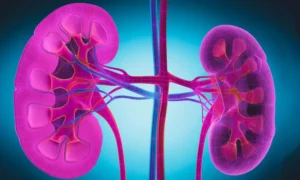 Read more about the article FDA Approves  Obinutuzumab for Active Lupus Nephritis
