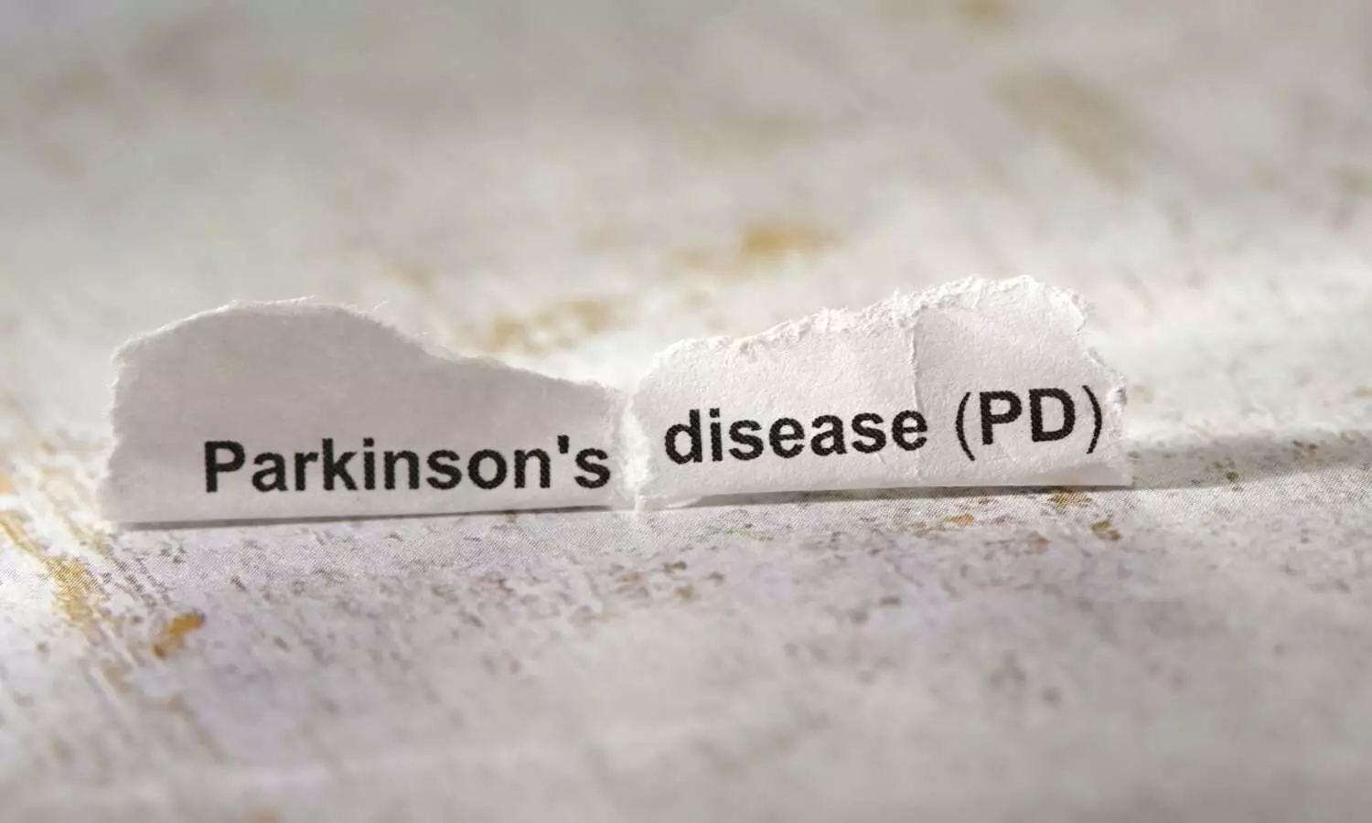 You are currently viewing No Evidence That Appendix Removal Influences Parkinson’s Disease Development: Meta-Analysis