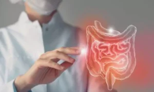 Read more about the article Low-Dose Aspirin Cuts Recurrence Risk in PI3K-Altered Colorectal Cancer, Trial Shows