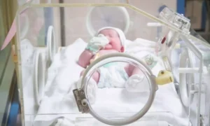 Read more about the article Fluid Restriction Fails to Improve PDA Outcomes, Hampers Growth in Preterm Infants: Study Shows