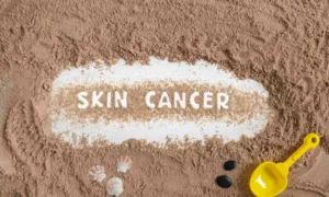 Read more about the article Atopic dermatitis patients undergo increased risk of nonmelanoma skin cancer: Study