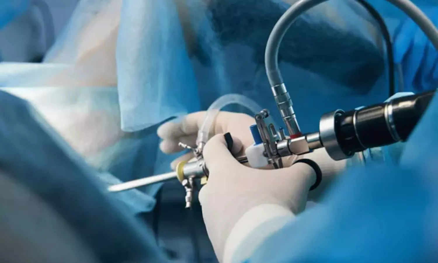 You are currently viewing Hysteroscopic diagnostic criteria highly accurate and sensitive for detecting chronic endometritis: Study