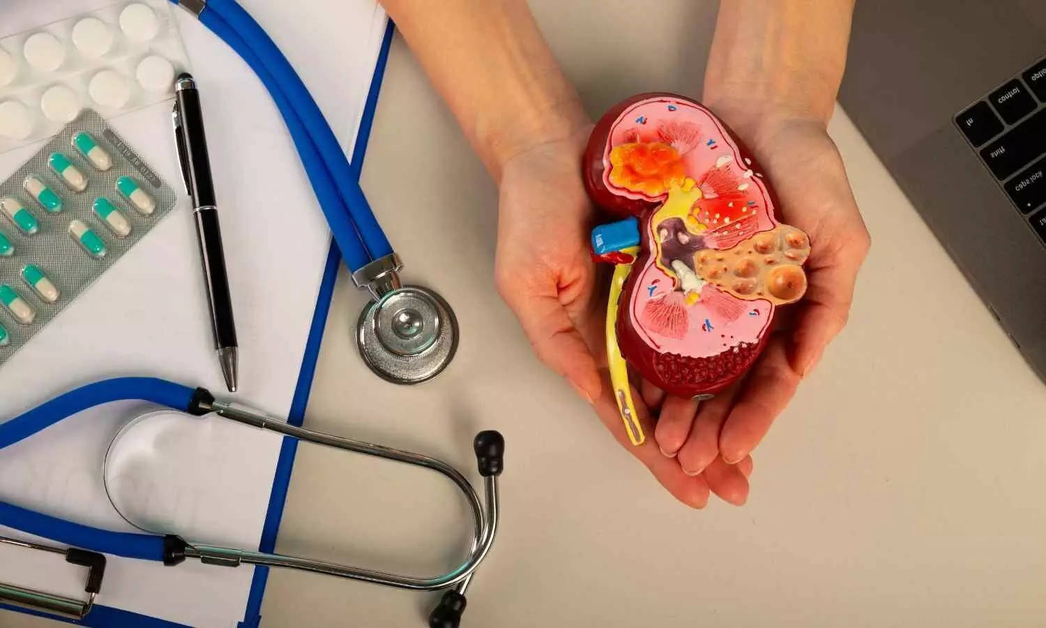 You are currently viewing Less can be more: Low-dose steroids could effectively treat severe kidney inflammation,  suggests study