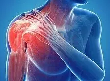 Read more about the article Managing irreparable rotator cuff tears requires comprehensive approaches to improve patient outcomes: study