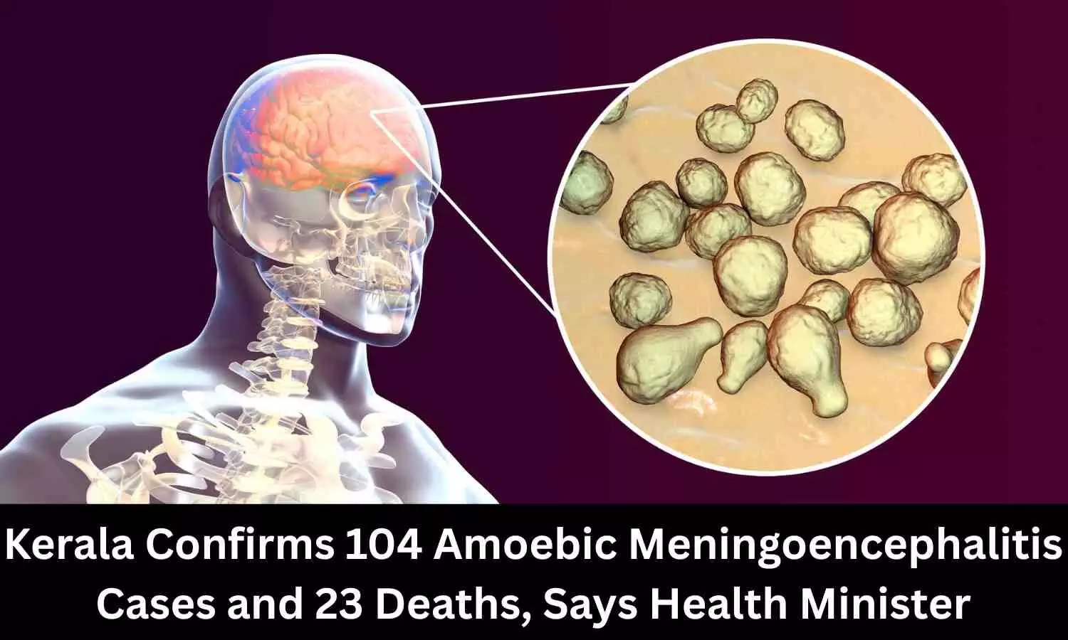 You are currently viewing 104 Amoebic Meningoencephalitis Cases and 23 Deaths, Says Kerala Health Minister