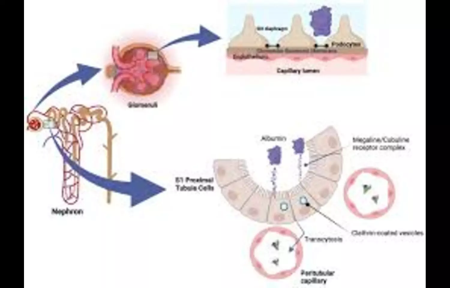 Read more about the article Lowering Albuminuria Improves Survival and Kidney Outcomes in Diabetes-Related CKD: Study