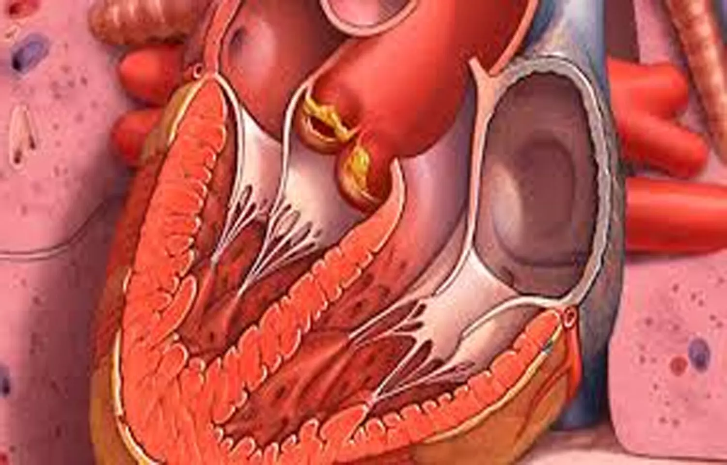 Read more about the article Female Patients with Culture-Negative Endocarditis Face Worse Prognosis,  suggests study