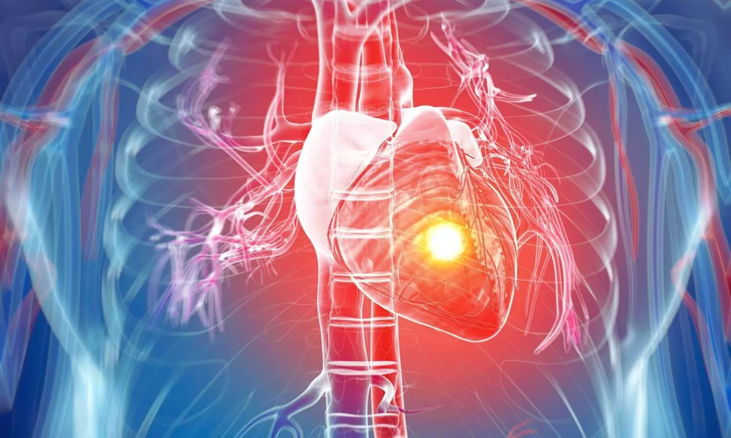 You are currently viewing Silent Heart Attacks Pose Long-Term Health Risks for Men Than Women: Study