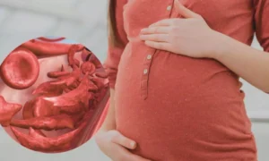 Read more about the article Iron isomaltoside efficient alternative to Iron Sucrose in treating postpartum anemia: Study