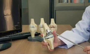 Read more about the article Knee Implant Prices Under Fresh Review: NPPA Weighs 10% Hike Request from Manufacturers