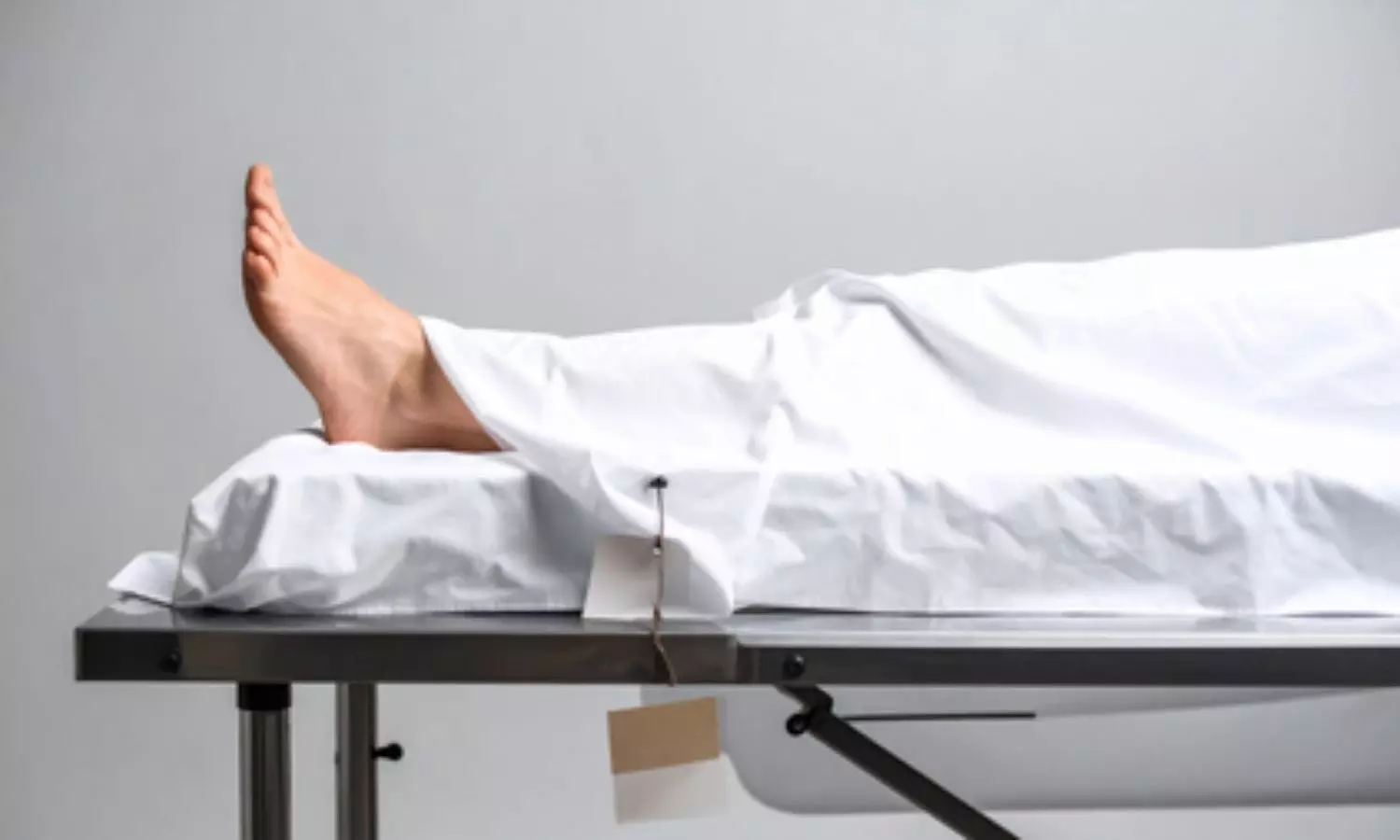 You are currently viewing Surat Homoeopathic doctor commits suicide by anesthesia overdose