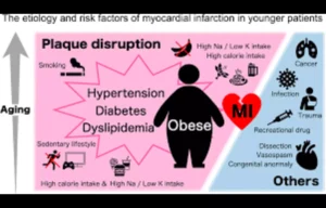 Read more about the article Abnormal Free Fatty Acids Amplify Long-Term Cardiovascular Risk in Premature MI: Study