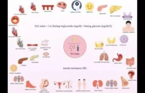 Read more about the article Elevated TyG Index Predicts Hyperuricemia Risk in T2DM: Study