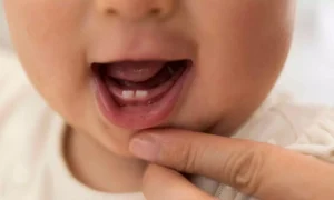 Read more about the article Teeth of babies of stressed mothers come out earlier, suggests study