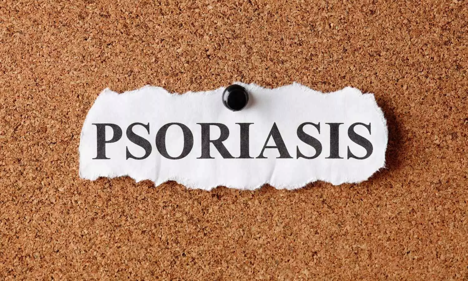 You are currently viewing Antibiotic Use May Reduce Biologic Treatment Persistence in Psoriasis: JAMA