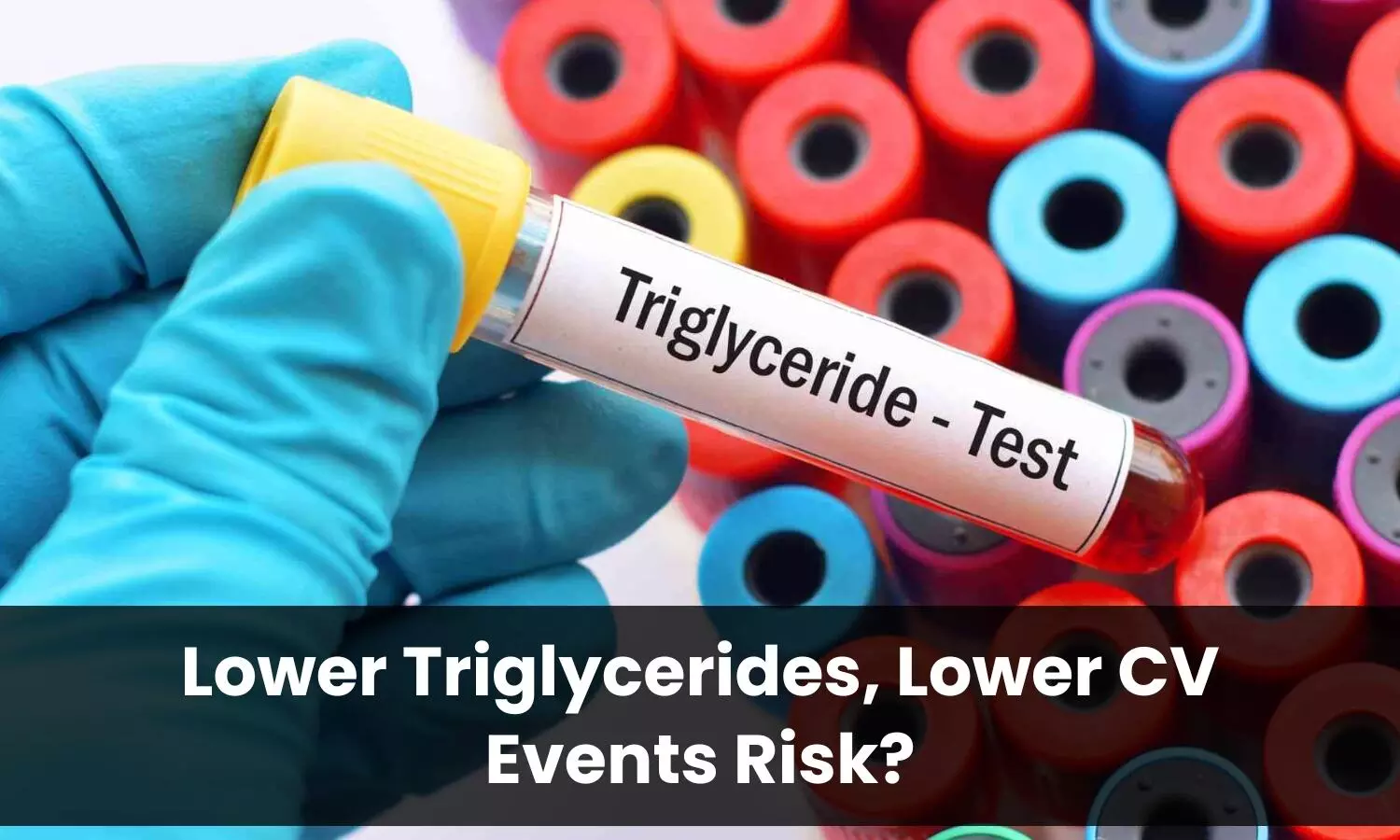 You are currently viewing Lower Triglycerides, Lower Risk? Large Real-World Study Finds Only Modest Cardiovascular Benefit, December 2025 Published AHJP Study