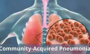 Read more about the article Traditional Chinese Medicine Injections Show Potential Benefit in Older Adults With Community-Acquired Pneumonia