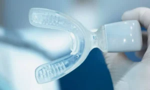 Read more about the article AcceleDent Vibration Doesn’t Induce Thermal Effects in Intraoral Tissues: Study