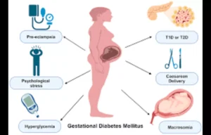 Read more about the article Probiotics in Pregnancy: Reduced GDM Risk but Increased Preeclampsia and Gestational Age: Study