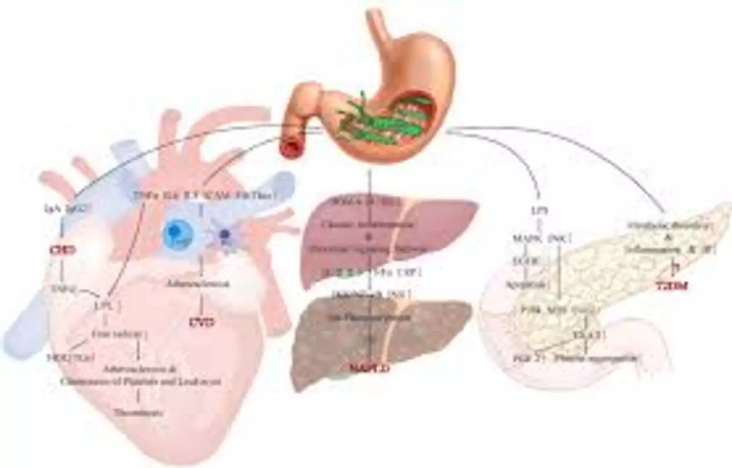 You are currently viewing H. pylori Infection Linked to Elevated remnant cholesterol Levels via Insulin Resistance and Inflammation: Study